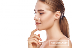 Rhinoplasty